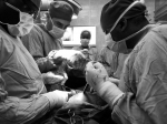 9. ARTROPLASTIA DE CADERA. EXPERIENCIA EN ÁFRICA